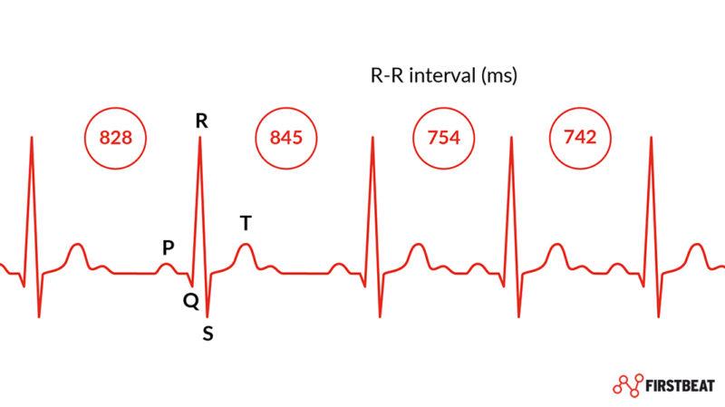 Heart Rate Variability (HRV): What It Is & How to Improve It