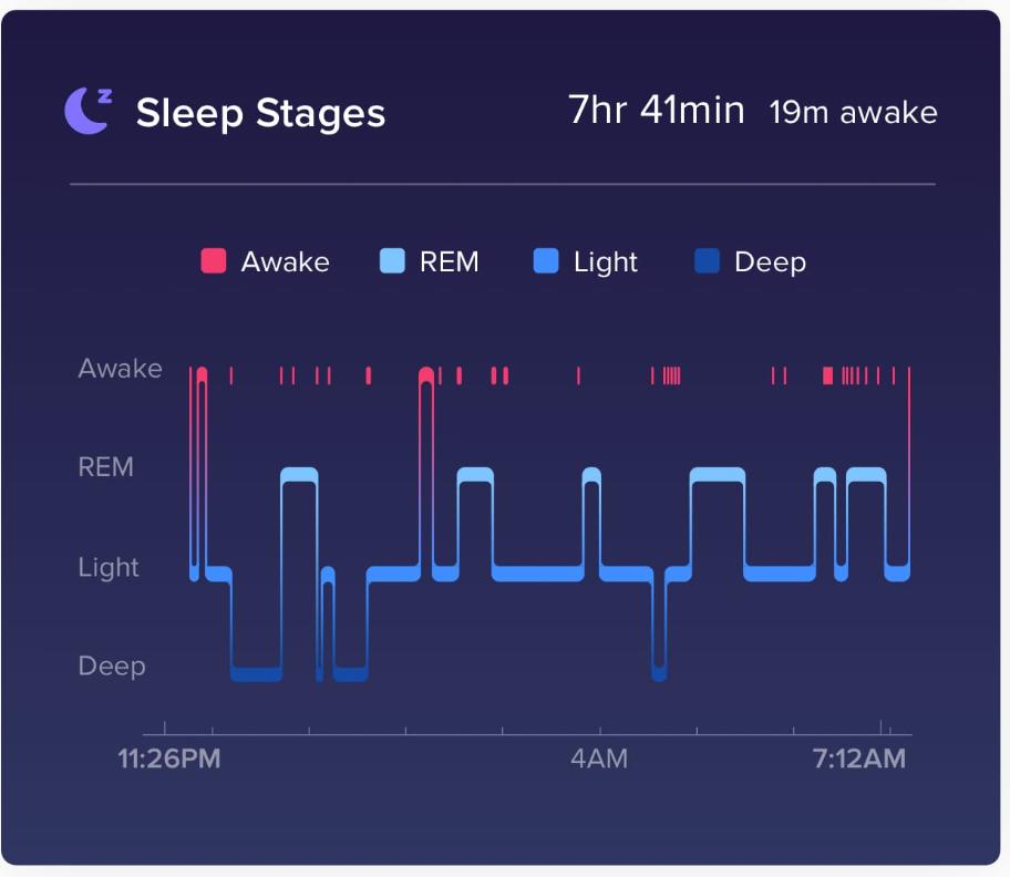Vagus Nerve Stimulation for Sleep: A 4-Week Protocol (2026)